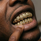 Diamond Lattice Grillz in Gold