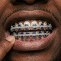 Blue Sapphire & Diamond Grillz Set