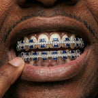 Blue Sapphire & Diamond Grillz Set