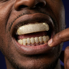 Ice Bar Grillz in Gold