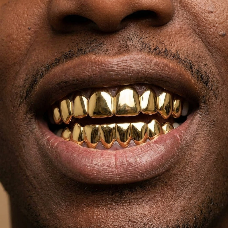 Gold Full-Coverage Grillz