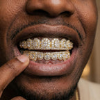 Iced Out Diamond Cluster Grillz Set in Gold
