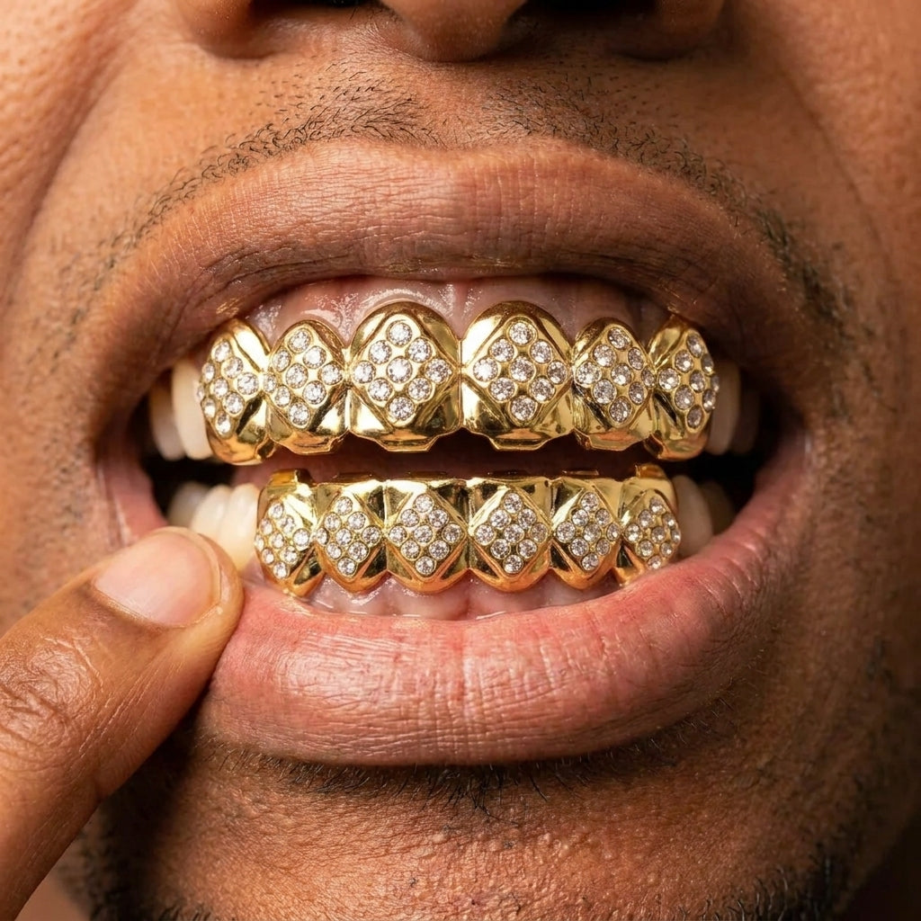 Gold Iced Diamond Grillz Set