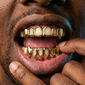Gold Open-Face Fang Grillz