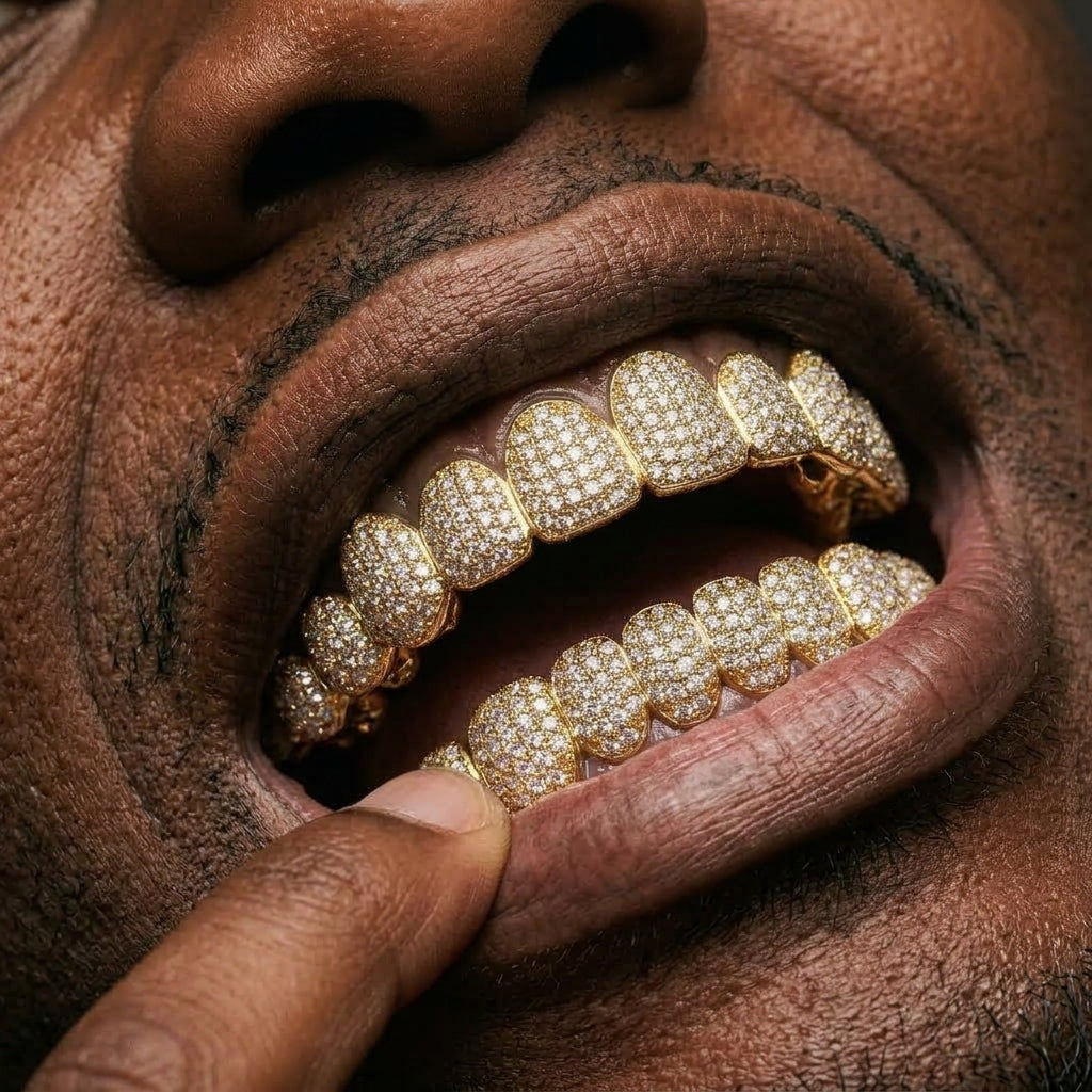Iced Out Full Set Grillz in Gold