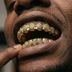 Diamond Lattice Grillz in Gold