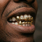 Gold Iced Fang Grillz