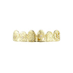 Royal Crest Grillz in Gold