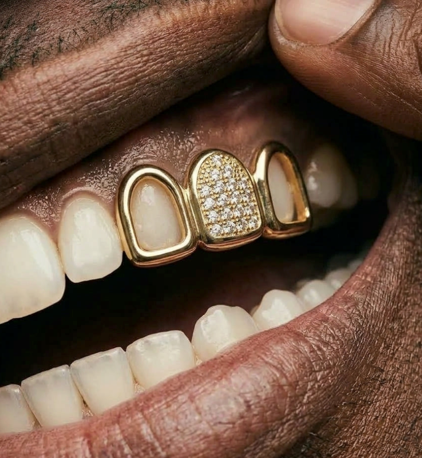 Gold Open Face Diamond Grillz