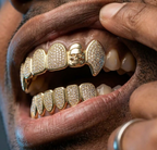 Iced Skull & Diamond Full Set Grillz in Gold