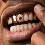 Ruby Diamond Halo Grillz in Gold