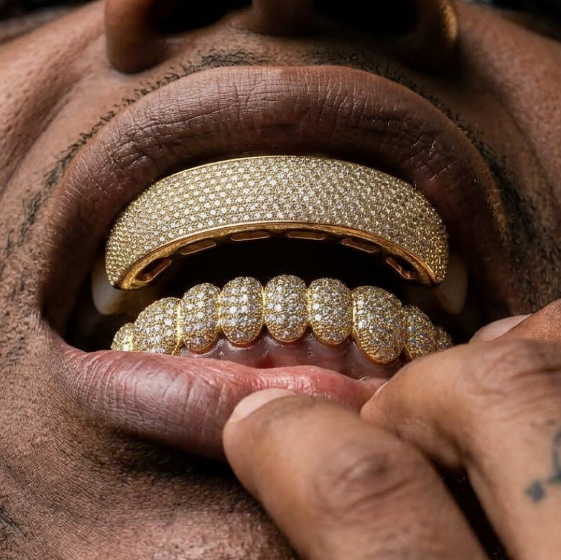 Ice Bar Grillz in Gold