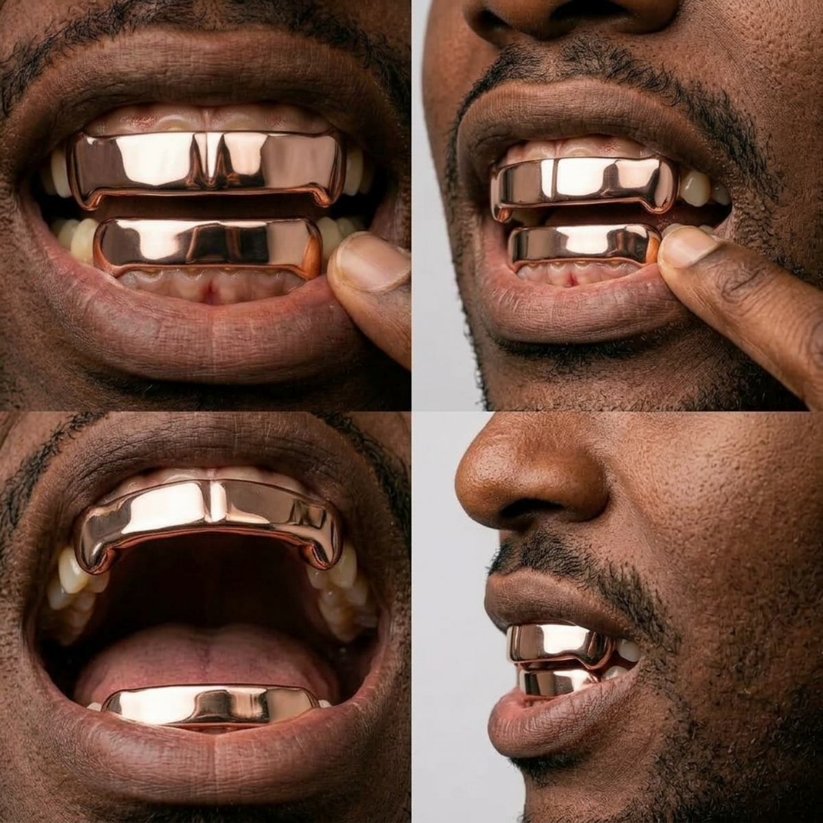 Rose Gold Full-Coverage Grillz Set
