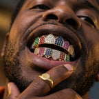 Rainbow Cathedral Gemstone Grillz in Gold