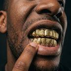 Gold Slash Grillz