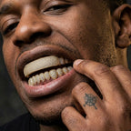 Ice Bar Grillz in Gold
