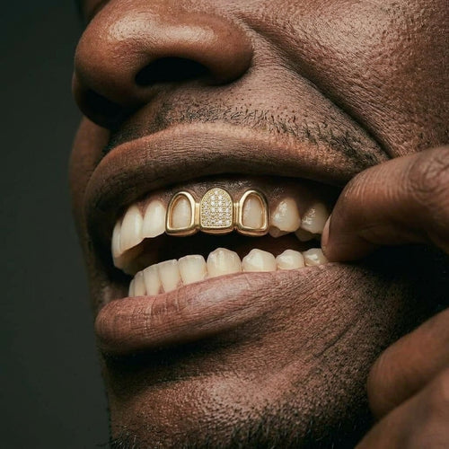 Gold Open Face Diamond Grillz