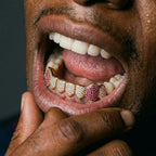 Purple Reign Grillz in Gold