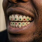 Iced Out Multi-Color Gemstone Grillz Set