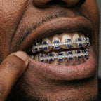 Blue Sapphire & Diamond Grillz Set