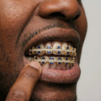 Blue Sapphire & Diamond Grillz Set in Gold
