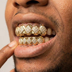 Gold Iced Diamond Grillz Set