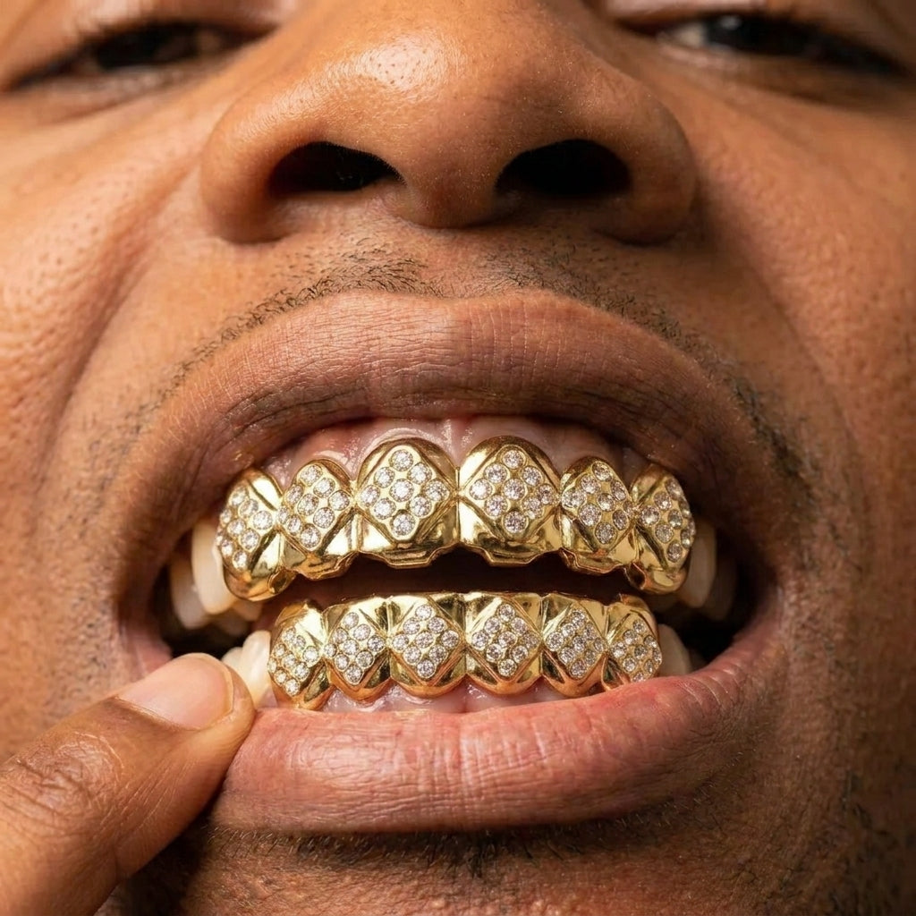 Gold Iced Diamond Grillz Set